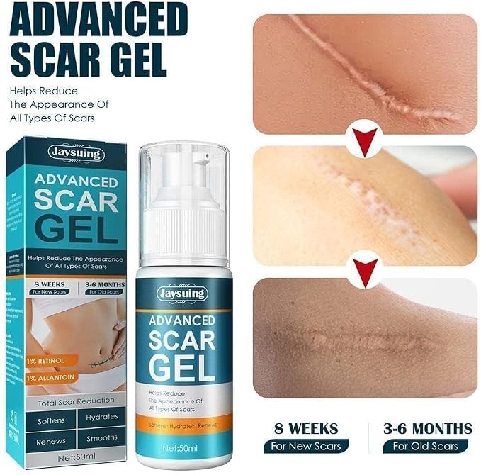 20912
